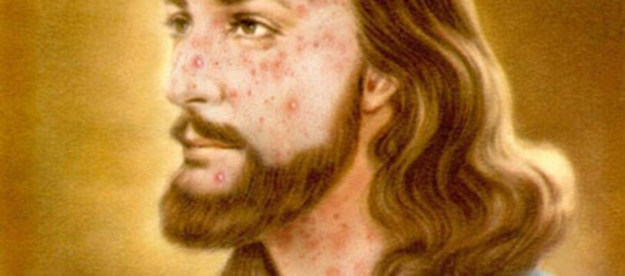 jesus-zits